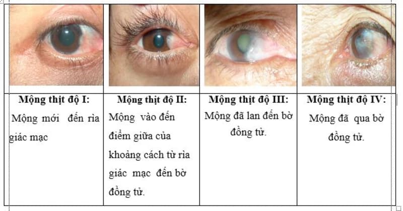 CHĂM SÓC BỆNH NHÂN SAU PHẪU THUẬT MỘNG