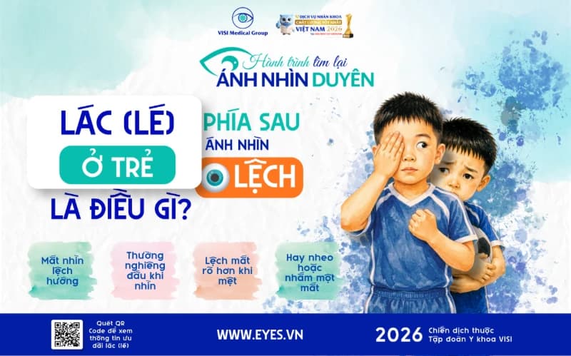 Lác (lé) ở trẻ: Phía sau ánh nhìn lệch là điều gì?