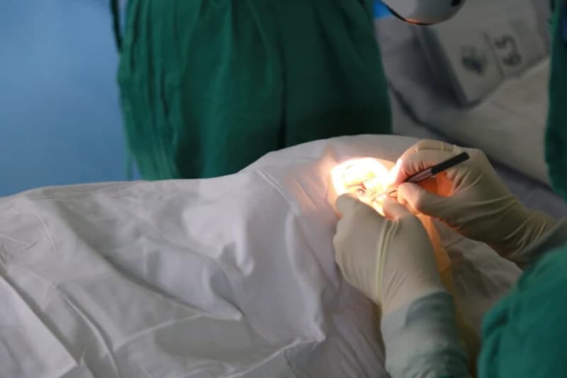 NHỮNG TIẾN BỘ TRONG ĐỤC THỂ THỦY TINH VÀ SỰ KHÁC BIỆT TRONG PHẪU THUẬT PHACO CỦA BỆNH VIỆN MẮT HOA LƯ