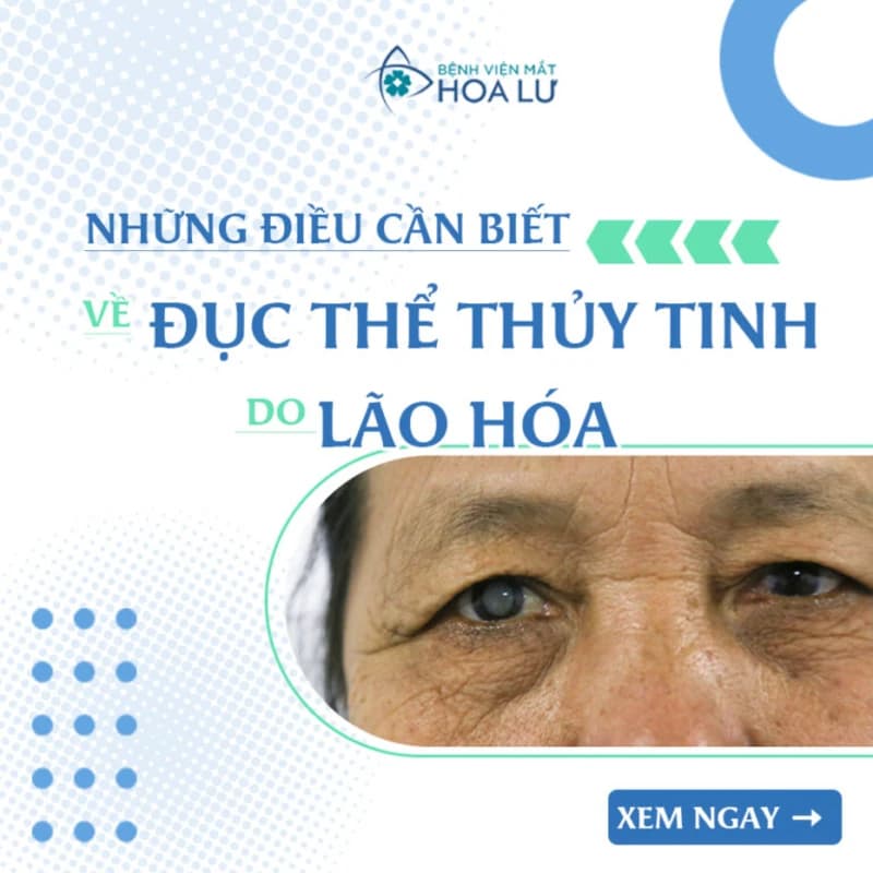 NHỮNG ĐIỀU CẦN BIẾT VỀ ĐỤC THỂ THỦY TINH DO LÃO HÓA
