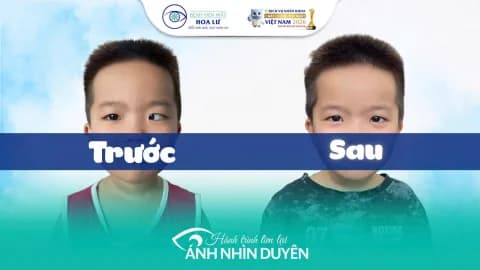 Đừng để lác mắt trở thành lý do con mặc cảm khi đi học