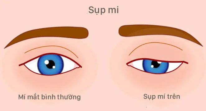 sup-mi_20260807_112421_615.png
